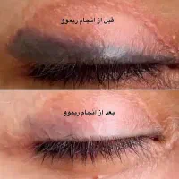 افتتاحیه آموزش و خدمات آرایش دائم،لیفت،اصلاح ابرو|خدمات آرایشگری و زیبایی|تهران, اقدسیه|دیوار