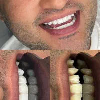 کاشت مو،عمل بینی،زیبایی دندان و پیکرتراشی