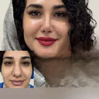 دکتر اسدالله‌پور، جراح برتر بینی در مازندران|خدمات آرایشگری و زیبایی|قائم‌شهر, |دیوار
