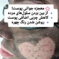 فشیال وپیلینگ هالیوودی