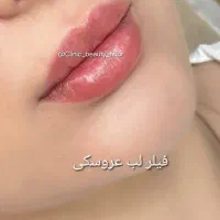 کلینیک زیبایی گلد( فیلر ژل بوتاکس) توسط پزشک|خدمات آرایشگری و زیبایی|سنندج, |دیوار