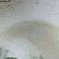 پاکسازی رشک و شپش