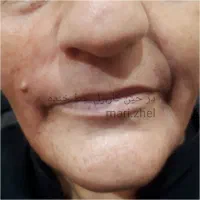 خدمات واموزش تخصصی ژل بوتاکس تتو چالگونه پرسینگ|خدمات آرایشگری و زیبایی|اهواز, کوی باهنر|دیوار