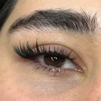 کاشت هیدن ۱۵۰ تو‌مان