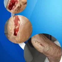 پانسمان نوین،خدمات پرستاری،تزریقات سرم تراپی|خدمات آرایشگری و زیبایی|اهواز, کیانپارس |دیوار