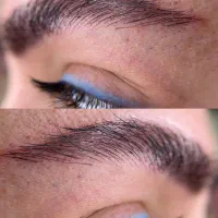 بهترین فیبروز کاره ساری