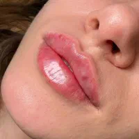 مرکز زیبایی با بروزترین دستگاه های روز دنیا