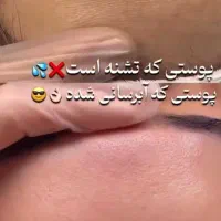 درمان انواع مشکلات پوست و مو|آرایشی، بهداشتی، درمانی|بروجرد, |دیوار