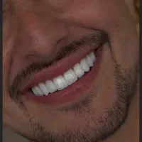 دندانپزشکی زیبایی در‌کرمان