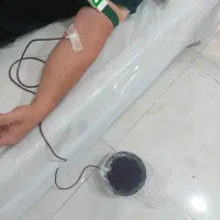 حجامت.زالودرمانی.فصد خون.بادکش|خدمات آرایشگری و زیبایی|سهند, |دیوار