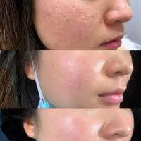 دو هفته ای سفید شو دعام کن (۱۸ کاره بیوممتیک)