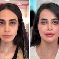مدل فیلرسیسی ۴۰۰فقط امروز فول فیس