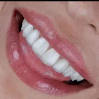 کامپوزیت|خدمات آرایشگری و زیبایی|اهواز, گلستان|دیوار