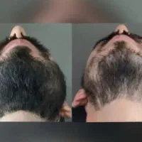 تا محرم پرپشت کن