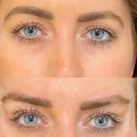 آموزش تزریق بوتاکس|خدمات آموزشی|فردیس, فرامرزیه|دیوار