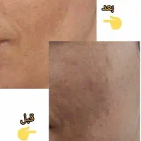 مشاوره تخصصی پوست ومو وپیشنهاد بهترین محصولات