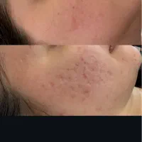 فیشال پوست برای خانمهاوآقایان|خدمات آرایشگری و زیبایی|کرمانشاه, |دیوار