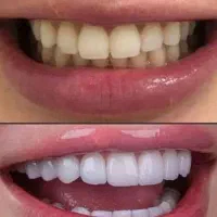 دندانپزشکی