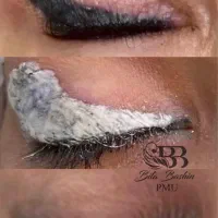 ریمور تتوی قدیمی صورت