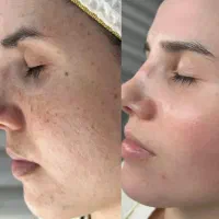 کار در منزل برای خانم های بالای ۱۸ سال|استخدام بازاریابی و فروش|یاسوج, |دیوار