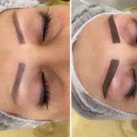 میکروبلیدینگ تغییررنگ ابروی تیره ۵۰۰