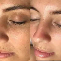 جشنواره ویژه فیشیال تخصصی با اف 50 درصد