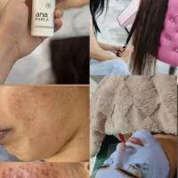 تخفیفات فیشال اصلاح صورت مژه رنگ کراتین آموزش ناخن|خدمات آرایشگری و زیبایی|بندرعباس, |دیوار