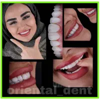 فستیوال اقساطی دندان پزشکی خدمات دندانپزشکی|خدمات آرایشگری و زیبایی|اصفهان, دشتستان|دیوار