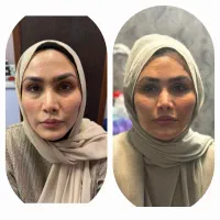 ارائه انواع خدمات زیبای درمطب توسط پزشک|خدمات آرایشگری و زیبایی|قم, امامزاده ابراهیم|دیوار