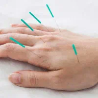 کلینیک طب سوزنی ـ سنتی سینا