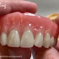 تعمیر و بازسازی پروتز دندان (در سریع‌ترین زمان)