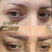 پاک کردن تتوابرو،خطچشم،خطلب(ریموو)|خدمات آرایشگری و زیبایی|شاهین‌شهر, شهرک میلاد|دیوار