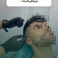 آخرین تخفیف ژل و فیلر، بوتاکس، مزوتراپی، پی آرپی|خدمات آرایشگری و زیبایی|آق قلا, |دیوار