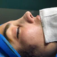 جراحی بینی عمل بینی انواع جراحی زیبایی|خدمات آرایشگری و زیبایی|ساری, |دیوار