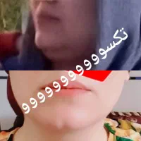 پکیج رفع غبغب طی سه ماه
