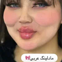 جشنواره50٪تخفیف فیلرمادلینگ صورت،کانتورینگ چانه لب