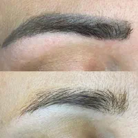 پاک کردن تتو و خالکوبی با دستگاه لیزر|خدمات آرایشگری و زیبایی|زنجان, |دیوار