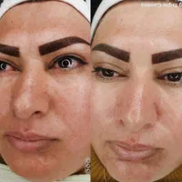 خدمات و آموزش تخصصی فشیال