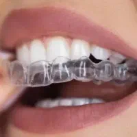 ارتودنسی شفاف