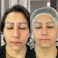 خدمات و آموزش تخصصی پوست و زیبایی|خدمات آرایشگری و زیبایی|شیراز, ارم|دیوار