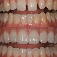 منشی و دستیار دندانپزشک نیمه وقت|استخدام درمانی، زیبایی، بهداشتی|فردیس, سرحدی|دیوار