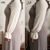 لاغری سریع و بدون بازگشت تضمینی باکرایولیپولیز