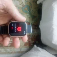اسمارت واچ