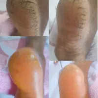 کفسابی پدیکور و رفع تیرگی تخفیف ب مدت ۲ روز|خدمات آرایشگری و زیبایی|فولادشهر, B2|دیوار
