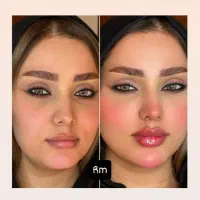 ۵۰ درصد تخفیف تزریق صورت سبک عربی هالیوودی لب روسی|خدمات آرایشگری و زیبایی|ری, دیلمان|دیوار