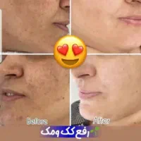 کرم vip بزرگ ضدلک و سفید کننده|آرایشی، بهداشتی، درمانی|گرگان, |دیوار