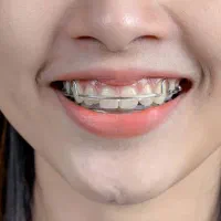 ارتودنسی کی خوبه