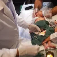 ختنه نوزاد