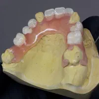 آموزش  دندانسازی مصنوعی به روش جدید.|خدمات آموزشی|شیراز, پارک آزادی|دیوار