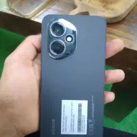 گوشی آنر 400 . درحد صفر